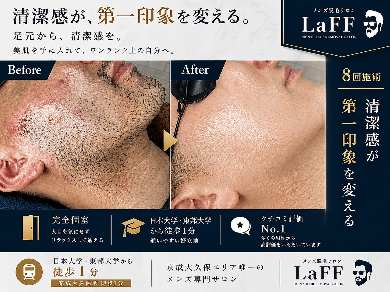 【新品未開封】脱毛ラボ4点セット+おまけ(エステ券) ラフ(LaFF)｜ホットペッパービューティー