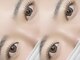 リュネル(Lunelle)の写真
