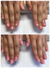 アクア ライズ 上大岡店(Aqua Rise)/初回【深爪矯正】￥７９８０