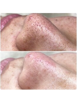 プアラ(puala)/before after