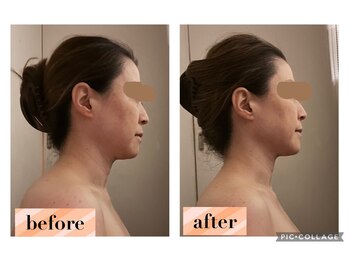 マンダ 田町(Manda)/フェイスラインと首肩がスッキリ