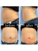 サロン エムイー(Salon ME)/痩身マシン!!エルフィーノ