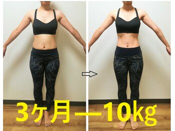 かんだ接骨院/32歳　骨盤ダイエット正面