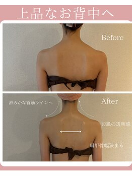 アティレ オオサカ(Attirer Osaka)/施術2回目/ブライダル/春挙式