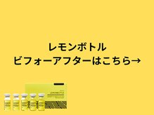 ア クーユ 相模大野店/レモンボトル/二重あご/小顔
