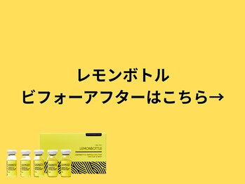 ア クーユ 相模大野店/レモンボトル/二重あご/小顔