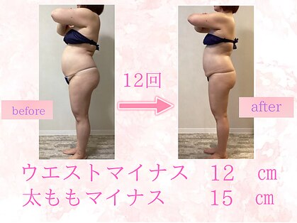 サロン ミオツクシ(SALON MIOTSUKUSHI)の写真