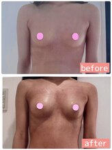 アイン 銀座(Ain)/バストアップ例　２