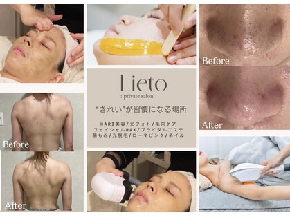 リエイト(Lieto)の写真