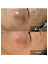 ビューティリュクス(beauty luxe)/諦めかけた肌悩み、ハーブで解決