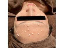 ニコリ(nicori)の雰囲気（短期間で肌質改善を本気でしたい方は絶対セルマン！！）