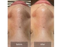 ラウレア(Laule’an)