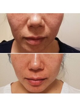 プレシャスサロン(precious salon)/30代女性 Before&After