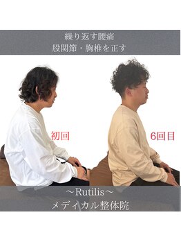 ルチルス(Rutilis)/腰痛改善整体