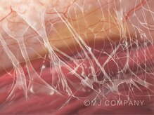 サンポ(SANPO)/わるい所は潰れ癒着しています。