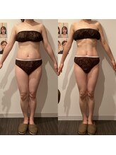 イロドリ 南浦和(irodori)/産後骨盤矯正Before＆After