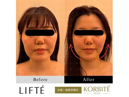 リフテ(LIFTE)の写真