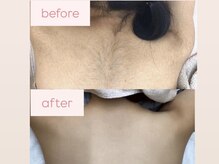 アルゴ 熊本光の森店(ALGO)/自分では手の届かないところも◎