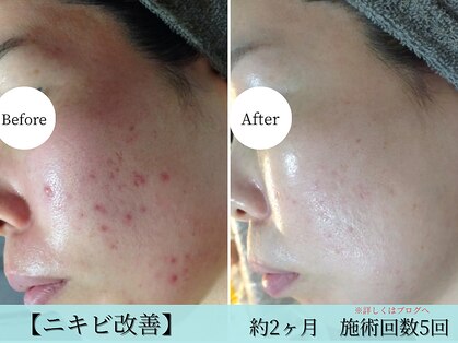 ルノン(LUNON)の写真