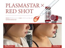 メロー(MELLOW)の雰囲気(RED SHOT取り扱い店EMS×プラズマ×カッサセットでスッキリ!)