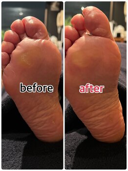 メディカルジャパン 吉祥寺/フットケア