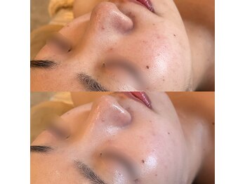 ラドンナ(LA DONNA)/水分不足による色むら・赤み