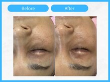 トウメイコガオ 横浜店/