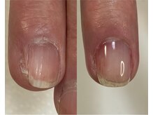 ロンディネ(Rondine)/自爪育成