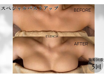 エレンシア(E'lencia)の写真