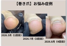 エム 平岸(M)
