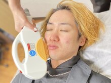 カラン(CALaN)/メンズ髭脱毛