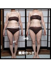 オアシス(OASIS)/全身痩身かっさ