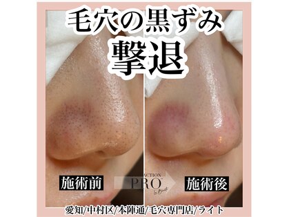 ライトの写真