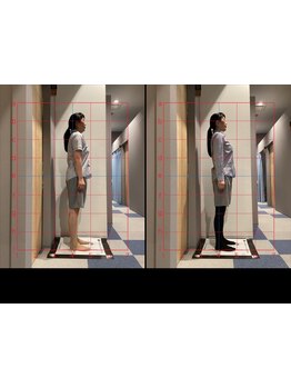 体の歪みをとりたい