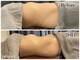サロンドアン(Salon de an)の写真