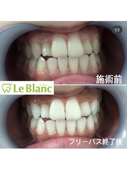 ルブラン 奈良店(Le Blanc)/就活の前に!