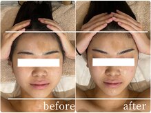 ルナリア ルクス 志木南口駅前店/リフトアップ　Before/After