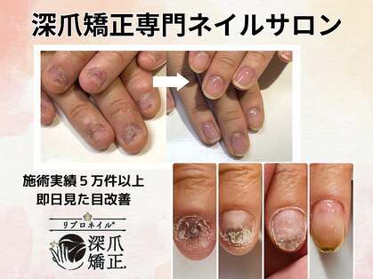 エルナ(elna)の写真