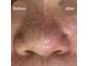レマンドゥースの写真