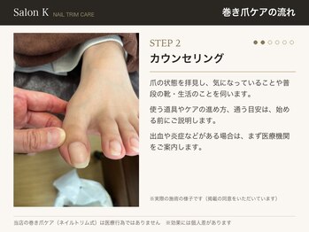 サロン ケー(Salon K)/巻き爪ケアの流れ2　相談