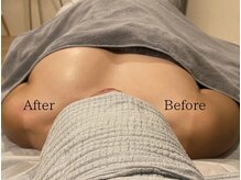 ラーグ(la-gu)/生体電流バストUP