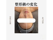 ルルアス(LUluas)の雰囲気（大人気！メイク落とさず最強小顔エステ！圧倒的な体感！！）