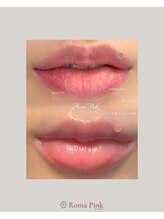 凰湖/【メラニンケア】ローマピンク