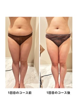 グレッシュ &nbsp;弘前店(Gresh)/★お客様のビフォーアフター★