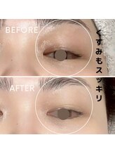 フェイエール鍼灸院 ラスィーヌ(fier鍼灸院 racine)/ラジオフェイシャル