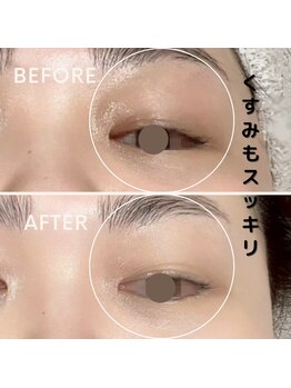 フェイエール鍼灸院 ラスィーヌ(fier鍼灸院 racine)/ラジオフェイシャル