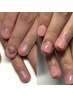 【キャンペーン価格♪1番人気お試し/女性ハンド】即日見た目が変わる深爪矯正