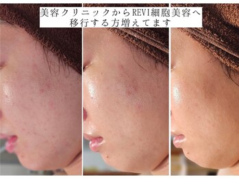 ユウビジン(YOU美人)/