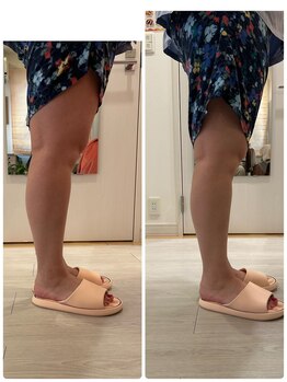 このか/足のむくみが軽減する!