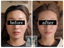 キュープ 富士店(Qpu)/元々小顔の方にも♪